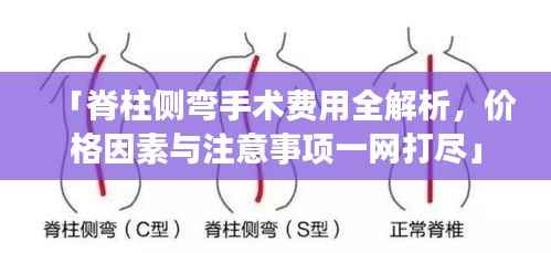 「脊柱侧弯手术费用全解析,价格因素与注意事项一网打尽」